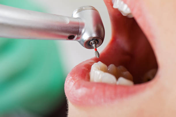 Best Emergency Dental Care for Broken or Chipped Teeth in Fairplains, NC